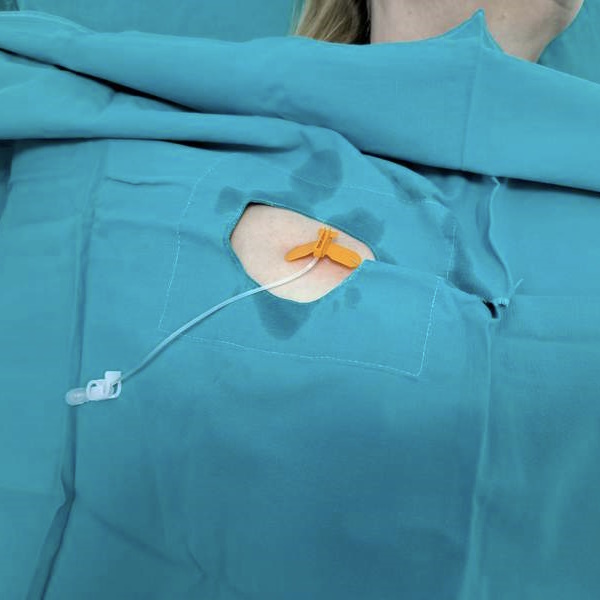 port za hemoterapiju punktiranje port za hemoterapiju punktiranje