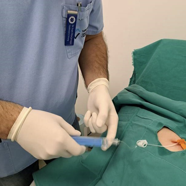 port za hemoterapiju ugradnja port za hemoterapiju ugradnja