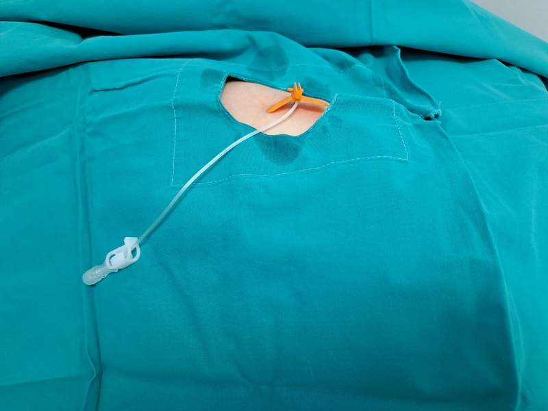 Kada se ugradi Port, &scaron;ta dalje?